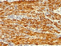 Calponin 1 Antibody (SPM169), Novus Biologicals 0.2mg; Unlabeled:Antibodies,
